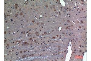 Immunohistochemistry (IHC) analysis of paraffin-embedded Rat Brain, antibody was diluted at 1:100.