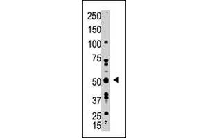 The GDF10 polyclonal antibody  is used in Western blot to detect GDF10 in A-375 cell lysate. (GDF10 anticorps  (N-Term))