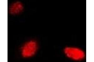 Immunofluorescent analysis of NUDT2 staining in Hela cells. (NUDT2 anticorps)