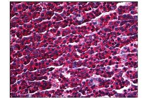 anti-Protein Kinase, Interferon-Inducible Double Stranded RNA Dependent Activator (PRKRA) antibody