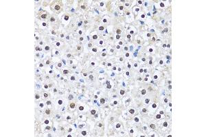 Immunohistochemistry of paraffin-embedded mouse liver using CCAR2 antibody.