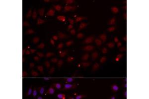Immunofluorescence analysis of HeLa cells using CST2 Polyclonal Antibody (CST2 anticorps)