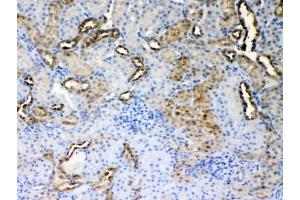 IHC testing of FFPE rat kidney tissue with ALDH1A3 antibody at 1ug/ml. (ALDH1A3 anticorps)