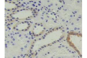 IHC-P analysis of Human Kidney Tissue, with DAB staining. (Calcyphosine anticorps  (AA 1-189))