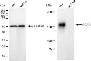 Western blotting analysis using EGFR antibody (ABIN7798462). (Recombinant EGFR anticorps)