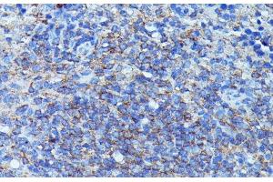Immunohistochemistry of paraffin-embedded Mouse spleen using CSF3 Polyclonal Antibody at dilution of 1:100 (40x lens). (G-CSF anticorps)