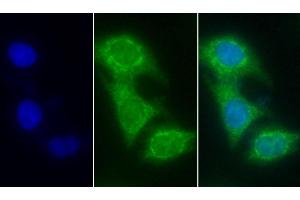 Detection of CYCS in Human Hela cell using Monoclonal Antibody to Cytochrome C (CYCS) (Cytochrome C anticorps  (AA 5-100))