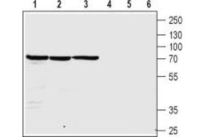 anti-Cholinergic Receptor, Nicotinic, beta 4 (Neuronal) (CHRNB4) (AA 95-108), (Extracellular) antibody
