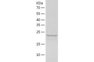 Western Blotting (WB) image for Small Nuclear Ribonucleoprotein Polypeptide B (SNRPB2) (AA 1-225) protein (His tag) (ABIN7125132) (SNRPB2 Protein (AA 1-225) (His tag))