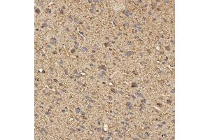 IHC analysis of SPTBN2 using anti-SPTBN2 antibody (ABIN7602111). (Spectrin, Beta, Non-erythrocytic 2 (SPTBN2) (AA 594-1909) anticorps)