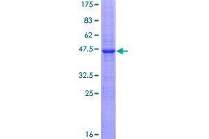 Image no. 1 for Cytochrome B5 Type B (Outer Mitochondrial Membrane) (CYB5B) (AA 1-146) protein (GST tag) (ABIN1350873)
