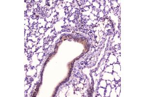 IHC testing of FFPE mouse lung tissue with Leptin antibody at 2ug/ml. (Leptin anticorps  (AA 22-167))