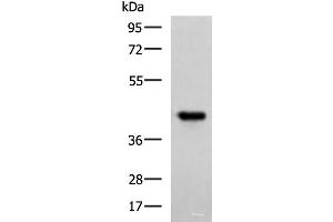 Western blot analysis of Ramos cell lysate using FCRLA Polyclonal Antibody at dilution of 1:750 (FCRLA anticorps)