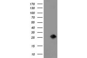 Western Blotting (WB) image for anti-Lin-7 Homolog B (LIN7B) antibody (ABIN1499156) (LIN7B anticorps)