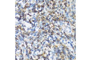 Immunohistochemistry of paraffin-embedded human tonsil using  antibody (ABIN1678742, ABIN3018765, ABIN3018766 and ABIN5664716) at dilution of 1:100 (40x lens).