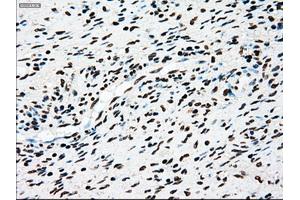 Immunohistochemical staining of paraffin-embedded Kidney tissue using anti-TYRO3mouse monoclonal antibody. (TYRO3 anticorps)
