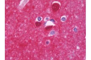 Anti-PPP3CB antibody IHC staining of human brain, cortex. (PPP3CB anticorps  (AA 63-393))