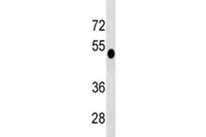 DUSP6 antibody western blot analysis in CEM lysate.