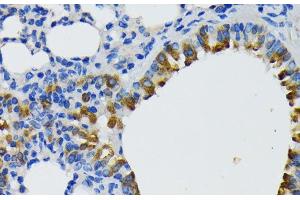Immunohistochemistry of paraffin-embedded Mouse lung using IQGAP1 Polyclonal Antibody at dilution of 1:200 (40x lens). (IQGAP1 anticorps)