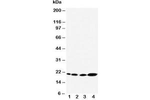 Western blot testing of Caveolin-2 antibody and Lane 1:  rat heart;  2: rat lung;  3: HeLa;  4: A431 cell lysate