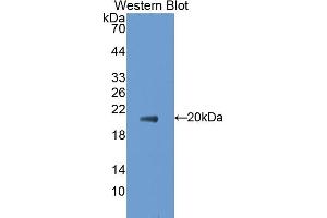 Detection of Recombinant CD30L, Mouse using Polyclonal Antibody to Cluster Of Differentiation 30 Ligand (CD30L)