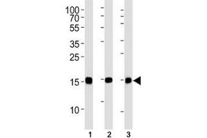 SUMO-2 antibody western blot analysis in (1) CEM, (2) 293, (3) rat C6 lysate. (SUMO2 anticorps)
