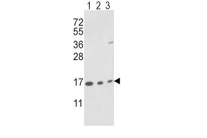 Western Blotting (WB) image for anti-Peptidylprolyl Isomerase A (Cyclophilin A) (PPIA) antibody (ABIN3001732) (PPIA anticorps)
