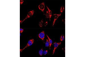 Confocal immunofluorescence analysis of HeLa cells using  antibody (ABIN3023384, ABIN3023385, ABIN3023386 and ABIN1678613) at dilution of 1:200. (AIF anticorps  (AA 334-613))