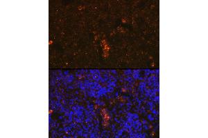 Immunofluorescence analysis of mouse spleen cells using Granzyme B Rabbit pAb (ABIN6127296, ABIN6141553, ABIN6141554 and ABIN6219658) at dilution of 1:100 (40x lens).