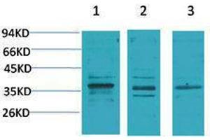 Western Blotting (WB) image for anti-Calcium Channel, Voltage-Dependent, gamma Subunit 2 (CACNG2) antibody (ABIN3181547)