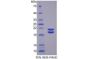 SDS-PAGE analysis of Mouse SPD Protein. (SFTPD Protéine)