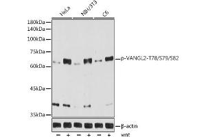 Western blot analysis of extracts of various cell lines, using Phospho-V-T78/S79/S82 antibody (ABIN7271292) at 1:1000 dilution. (VANGL2 anticorps  (pSer79, pSer82, pThr78))