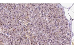 ABIN6273297 at 1/100 staining Human pancreas cancer tissue by IHC-P. (PIK3IP1 anticorps  (N-Term))