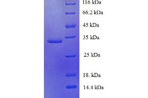 SDS-PAGE (SDS) image for Ubiquitin-Conjugating Enzyme E2 Variant 2 (UBE2V2) (AA 2-145) protein (His-SUMO Tag) (ABIN5710586)