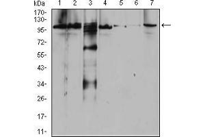 Western blot analysis using RAB11FIP1 mouse mAb against Raji (1), SW620 (2), A431 (3), SW480 (4), HepG2 (5), Hela (6), and NIH3T3 (7) cell lysate.