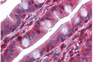 Human Small Intestine (formalin-fixed, paraffin-embedded) stained with TRAF2 antibody ABIN214009 at 5 ug/ml followed by biotinylated goat anti-rabbit IgG secondary antibody ABIN481713, alkaline phosphatase-streptavidin and chromogen. (TRAF2 anticorps  (N-Term))
