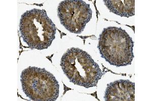 IHC analysis of IFT88 using anti-IFT88 antibody (ABIN7600458).