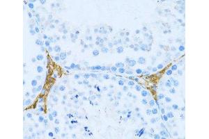 Immunohistochemistry of paraffin-embedded Mouse testis leydig using KLHL42 Polyclonal Antibody at dilution of 1:100 (40x lens). (KLHDC5 anticorps)