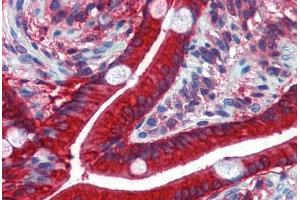 Human Small Intestine: Formalin-Fixed, Paraffin-Embedded (FFPE) (CES2 anticorps  (AA 514-622))