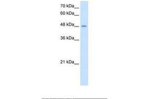 anti-Transmembrane Protease, serine 11D (TMPRSS11D) (AA 51-100) antibody