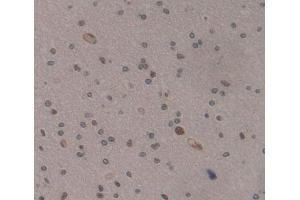 IHC-P analysis of Kidney tissue, with DAB staining. (MEF2A anticorps  (AA 1-162))