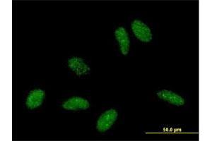 Immunofluorescence of purified MaxPab antibody to RBBP6 on HeLa cell. (RBBP6 anticorps  (AA 1-118))