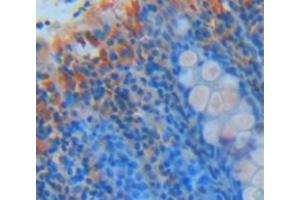 IHC-P analysis of Kidney tissue, with DAB staining. (Amyloid beta (A4) Precursor Protein-Binding, Family B, Member 1 Interacting Protein (APBB1IP) (AA 188-421) anticorps)