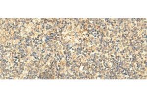 Immunohistochemistry of paraffin-embedded Human tonsil tissue using NTAN1 Polyclonal Antibody at dilution of 1:50(x200)