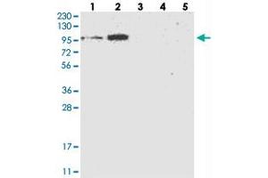 Western blot analysis of Lane 1: RT-4, Lane 2: U-251 MG, Lane 3: Human Plasma, Lane 4: Liver, Lane 5: Tonsil with FLJ22374 polyclonal antibody . (FAM188B anticorps)