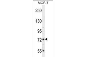 CTGE4 Antibody (N-term) (ABIN655781 and ABIN2845216) western blot analysis in MCF-7 cell line lysates (35 μg/lane).