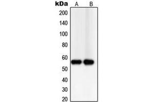 Western blot analysis of TXNRD2 expression in PC12 (A), Jurkat (B) whole cell lysates. (TXNRD2 anticorps  (C-Term))