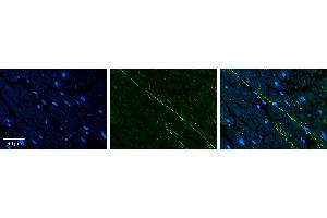 Rabbit Anti-KRT8 Antibody Catalog Number: ARP66386_P050 Formalin Fixed Paraffin Embedded Tissue: Human heart Tissue Observed Staining: Filaments Primary Antibody Concentration: 1:100 Other Working Concentrations: N/A Secondary Antibody: Donkey anti-Rabbit-Cy3 Secondary Antibody Concentration: 1:200 Magnification: 20X Exposure Time: 0.