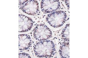 (ABIN6242434 and ABIN6577257) staining MBD2 in human colon tissue sections by Immunohistochemistry (IHC-P - paraformaldehyde-fixed, paraffin-embedded sections).