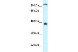 Image no. 1 for anti-Docking Protein 7 (DOK7) (AA 402-451) antibody (ABIN6747325)